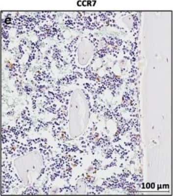 Immunohistochemistry-Paraffin: CCR7 Antibody [NB100-712]