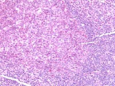 Immunohistochemistry-Paraffin: CCR7 Antibody - BSA Free [NBP2-31089]