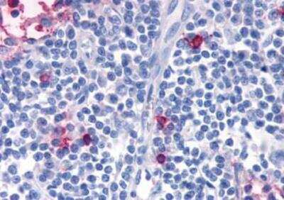 Immunohistochemistry-Paraffin: CCR7 Antibody - BSA Free [NBP2-31089]