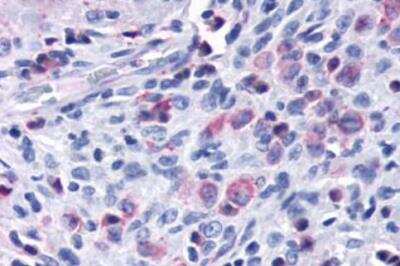 Immunohistochemistry-Paraffin: CCR7 Antibody - BSA Free [NBP2-31089]