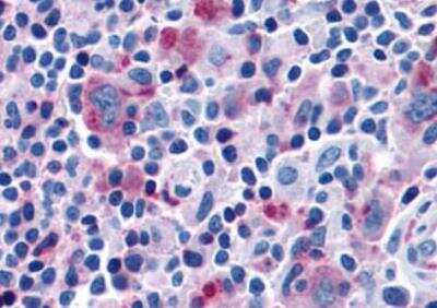 Immunohistochemistry-Paraffin: CCR7 Antibody - BSA Free [NBP2-31089]