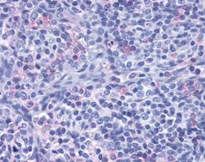 Immunohistochemistry-Paraffin: CCR7 Antibody - BSA Free [NLS847]