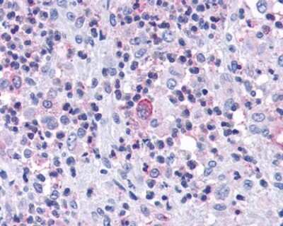 Immunohistochemistry-Paraffin: CCR7 Antibody - BSA Free [NLS847]