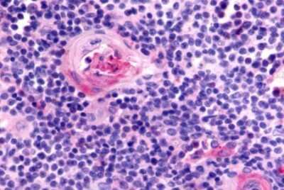 Immunohistochemistry-Paraffin: CCR7 Antibody - BSA Free [NLS847]