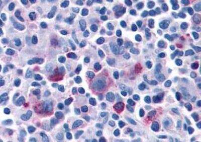 Immunohistochemistry-Paraffin: CCR7 Antibody - BSA Free [NLS847]