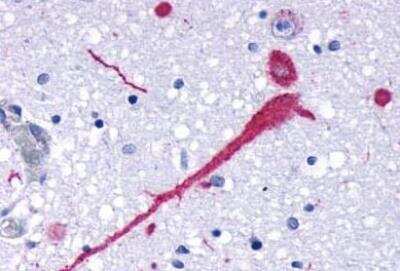 Immunohistochemistry-Paraffin: CCR7 Antibody - BSA Free [NLS847]