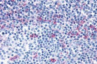 Immunohistochemistry-Paraffin: CCR7 Antibody - BSA Free [NLS847]
