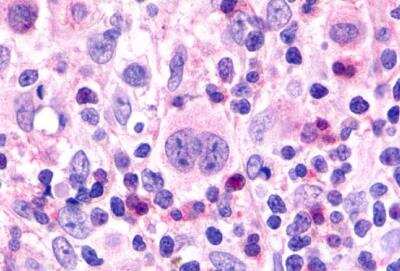 Immunohistochemistry-Paraffin: CCR7 Antibody - BSA Free [NLS847]