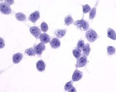 Immunohistochemistry-Paraffin: CCR7 Antibody - BSA Free [NLS848]