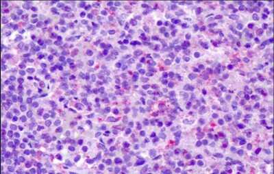 Immunohistochemistry-Paraffin: CCR7 Antibody - BSA Free [NLS848]