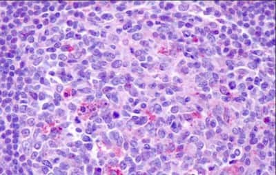 Immunohistochemistry-Paraffin: CCR7 Antibody - BSA Free [NLS848]