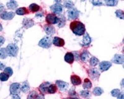 Immunohistochemistry-Paraffin: CCR7 Antibody - BSA Free [NLS848]