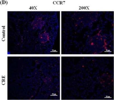Immunocytochemistry/ Immunofluorescence: CCR7 Antibody (SR36-04) [NBP2-67324]