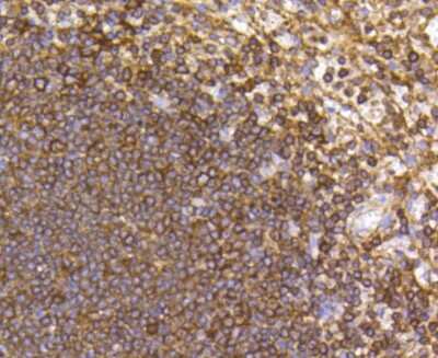 Immunohistochemistry-Paraffin: CCR7 Antibody (SR36-04) [NBP2-67324]