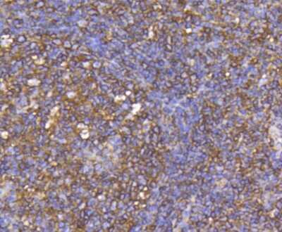 Immunohistochemistry-Paraffin: CCR7 Antibody (SR36-04) [NBP2-67324]