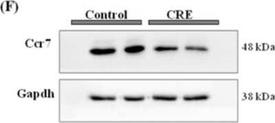 Western Blot: CCR7 Antibody (SR36-04) [NBP2-67324]