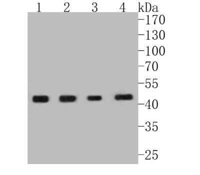 Western Blot: CCR7 Antibody (SR36-04) [NBP2-67324]