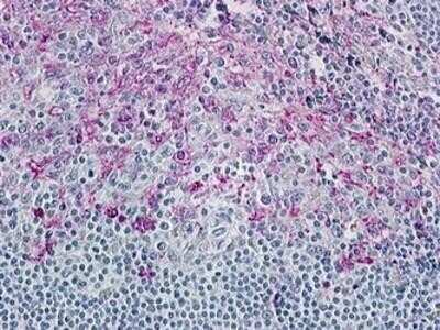 Immunohistochemistry-Paraffin: CCR8 Antibody - BSA Free [NBP1-02360]