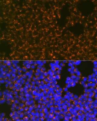 Immunocytochemistry/ Immunofluorescence: CCR8 Antibody (9N1Y1) [NBP3-16370]