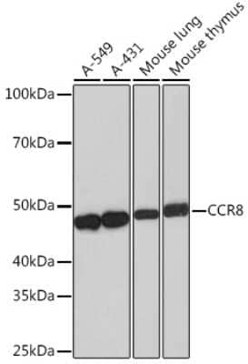 Western Blot: CCR8 Antibody (9N1Y1) [NBP3-16370]