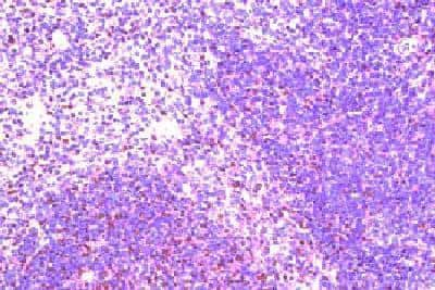 Immunohistochemistry-Paraffin: CCR8 Antibody [NB100-709]