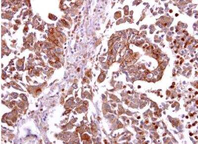 Immunohistochemistry-Paraffin: CCR8 Antibody [NBP2-15767]