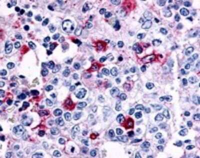 Immunohistochemistry-Paraffin: CCR8 Antibody - BSA Free [NLS3847]