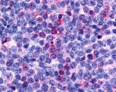 Immunohistochemistry-Paraffin: CCR8 Antibody - BSA Free [NLS3847]