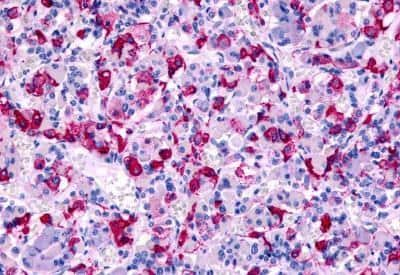 Immunohistochemistry-Paraffin: CCR8 Antibody - BSA Free [NLS3847]