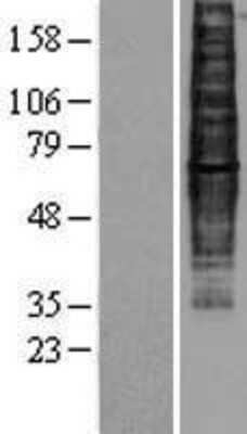 Western Blot: CCR9 Overexpression Lysate [NBP2-04314]