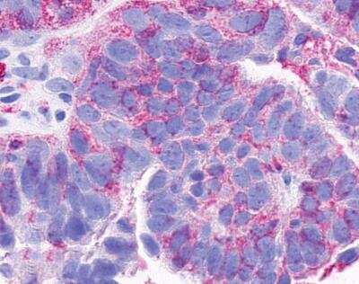 Immunohistochemistry-Paraffin: CCRL2/CRAM-A/B Antibody - BSA Free [NLS1093]