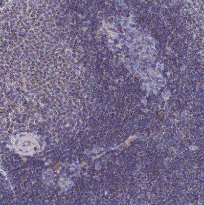 Immunohistochemistry-Paraffin: CCRL2/CRAM-A/B Antibody [NBP1-85588]