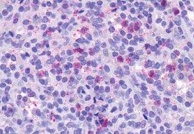 Immunohistochemistry-Paraffin: CCRL2/CRAM-A/B Antibody - BSA Free [NLS1093]