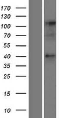 Western Blot: CCRL2/CRAM-A/B Overexpression Lysate [NBP2-09525]