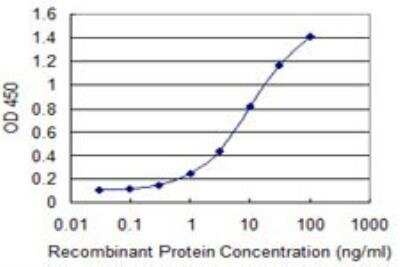 ELISA: CCS/SOD4 Antibody (1E2) [H00009973-M03]