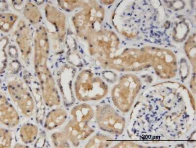 Immunohistochemistry-Paraffin: CCS/SOD4 Antibody (1E2) [H00009973-M03]