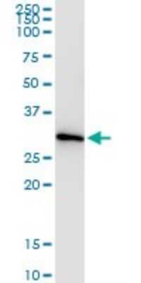 Immunoprecipitation: CCS/SOD4 Antibody (1E2) [H00009973-M03]