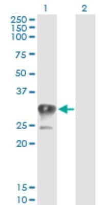 Western Blot: CCS/SOD4 Antibody (1E2) [H00009973-M03]