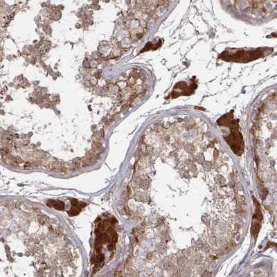 Immunohistochemistry-Paraffin: CCS/SOD4 Antibody [NBP2-55196]