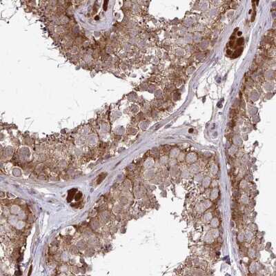 Immunohistochemistry-Paraffin: CCS/SOD4 Antibody [NBP2-58066]