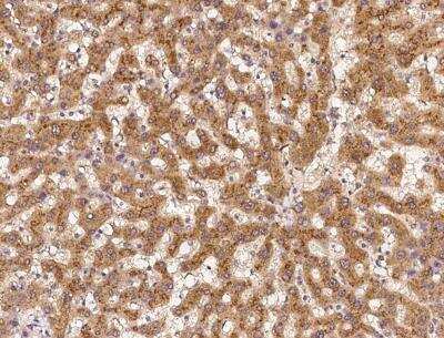 Immunohistochemistry-Paraffin: CCS/SOD4 Antibody [NBP3-12717]