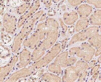 Immunohistochemistry-Paraffin: CCS/SOD4 Antibody [NBP3-12717]