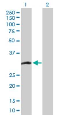 Western Blot: CCS/SOD4 Antibody [H00009973-D01P]