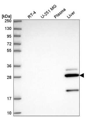 Western Blot: CCS/SOD4 Antibody [NBP2-58066]