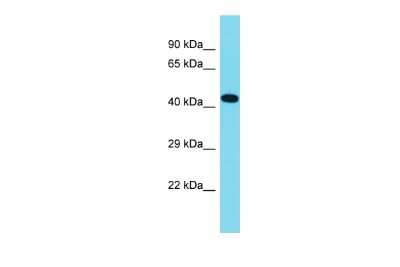 Western Blot: CCSMST1 Antibody [NBP3-10748]