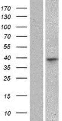 Western Blot: CCSMST1 Overexpression Lysate [NBP2-08765]