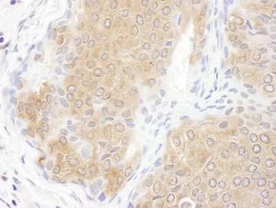 Immunohistochemistry-Paraffin: CCT3 Antibody [NBP1-79040]