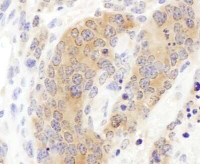 Immunohistochemistry-Paraffin: CCT3 Antibody [NBP1-79040]