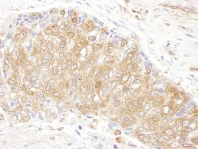Immunohistochemistry-Paraffin: CCT3 Antibody [NBP1-79041]