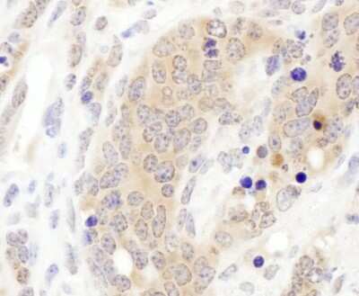 Immunohistochemistry-Paraffin: CCT3 Antibody [NBP1-79041]